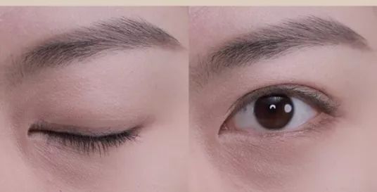 angelababy的双眼皮是什么情况,angelababy的脸整过容吗