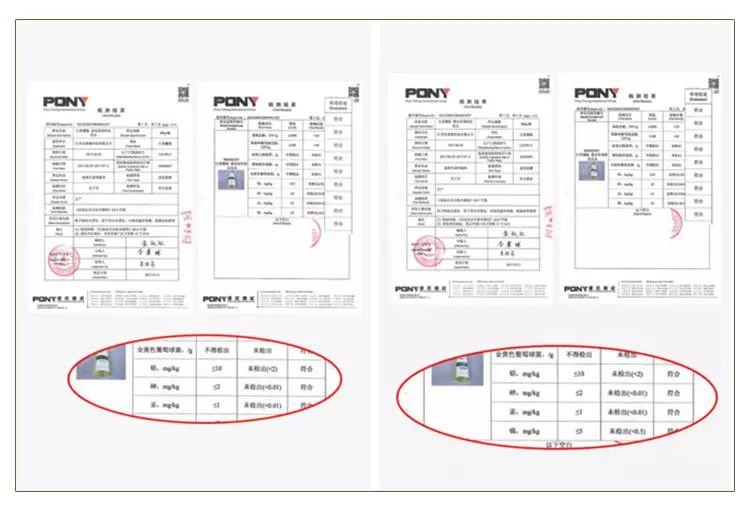 头皮痒头屑多有头螨怎么办,头螨大块头屑怎么治好得快