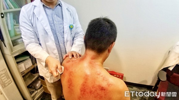 中医刮痧学注意事项,中医基础知识自学入门刮痧