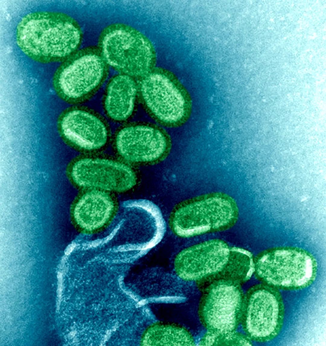 鍋囧鐥呮瘨鎰熸煋浜嗘垜,鍋囧鐥呮瘨鎰熸煋浜嗕綘