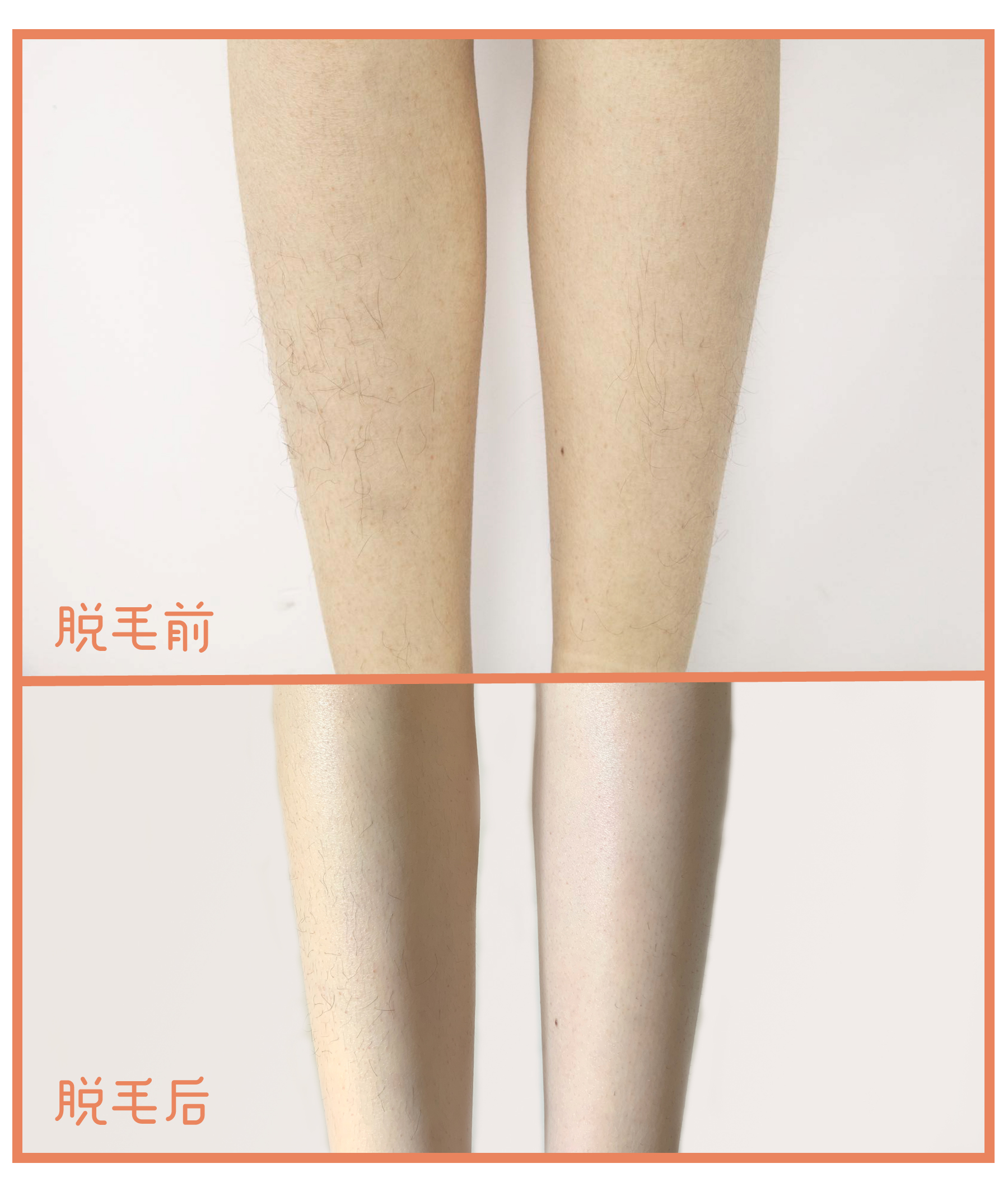 居家脱毛仪的推荐,家用脱毛仪哪一款光波最深