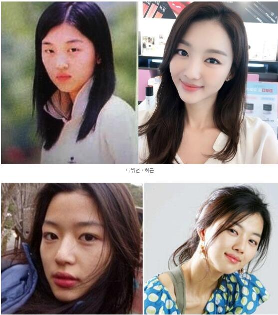 韩国明星谈整容,韩国明星整容失败