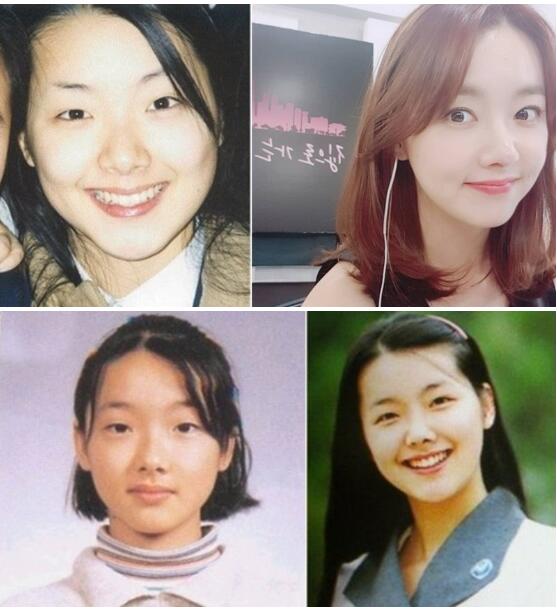 韩国明星谈整容,韩国明星整容失败