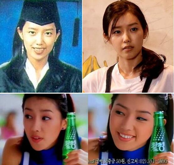 韩国明星谈整容,韩国明星整容失败