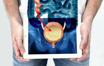 膀胱异物如何处理,膀胱里的异物