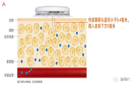 它是如何24h监测你的葡萄糖水平|一页手册·协和八