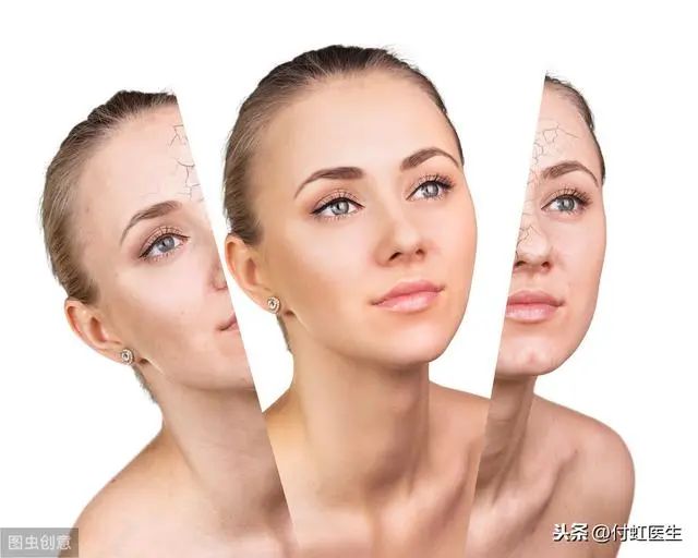 一个月瘦20斤的运动方法,两个月瘦20斤的最佳方法且不反弹