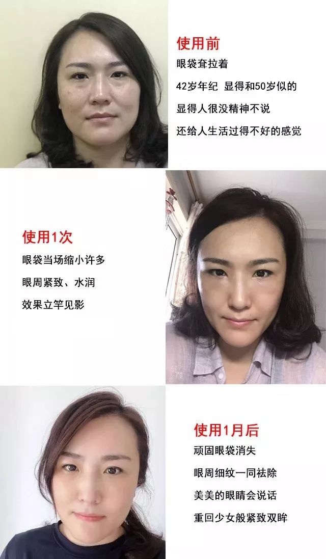不起眼的乳膏有哪些,药店有一种不起眼的乳膏