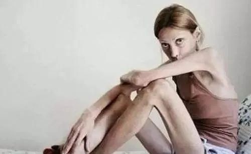 厌食症和暴食症同时出现,厌食症和贪食症的最主要的区别