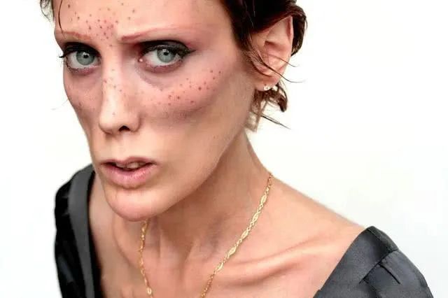 厌食症和暴食症同时出现,厌食症和贪食症的最主要的区别