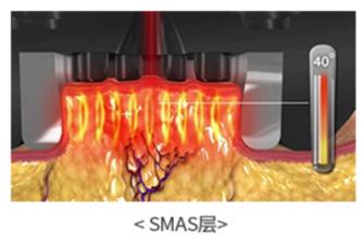 听说戴着口罩，集美们都偷偷在DO脸？