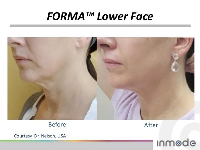 听说戴着口罩，集美们都偷偷在DO脸？