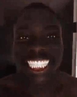 儿童换牙后牙齿长得不齐怎么办,换牙出现双排牙不齐怎么办