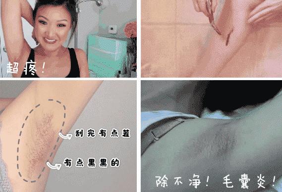 夏季脱毛必备,夏日必备脱毛告别尴尬
