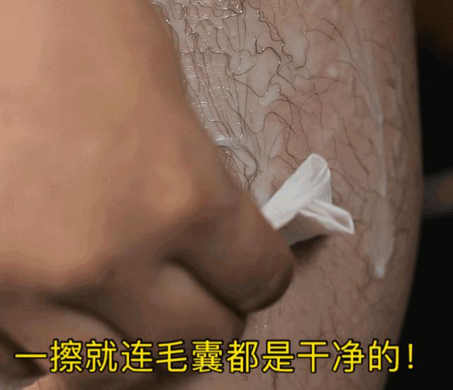 夏季脱毛必备,夏日必备脱毛告别尴尬