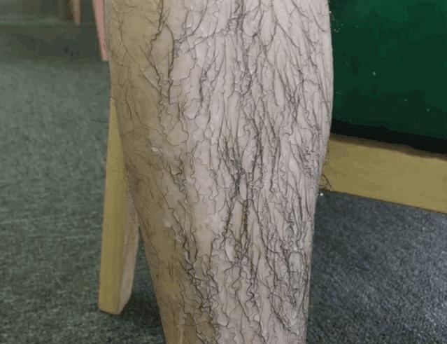 夏季脱毛必备,夏日必备脱毛告别尴尬