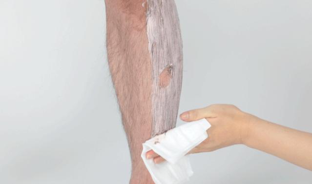 夏季脱毛必备,夏日必备脱毛告别尴尬