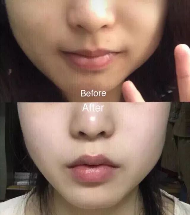 米皂美白,泰国大米皂美白效果