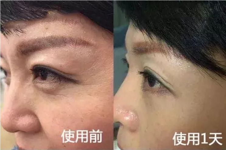 不起眼的乳膏有哪些,药店有一种不起眼的乳膏