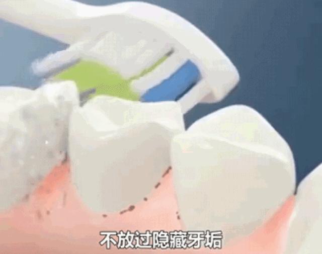 牙齿变黄你真的刷对了吗,牙齿黄了怎么办不用花钱去洗牙