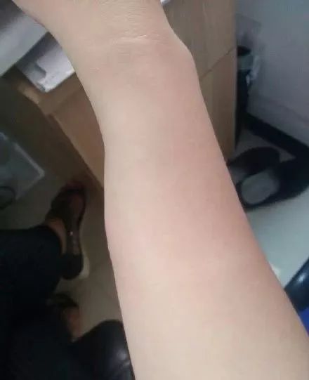 屋里白色小飞虫咬人,家里好多黑色的带壳小飞虫咬人吗