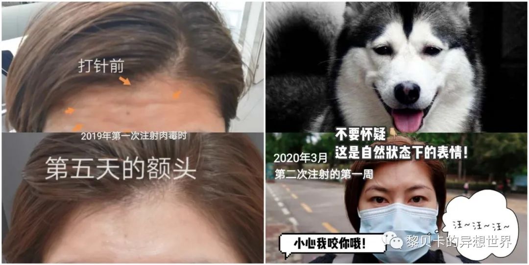 做完医美真的能换脸吗,做完医美需要注意什么