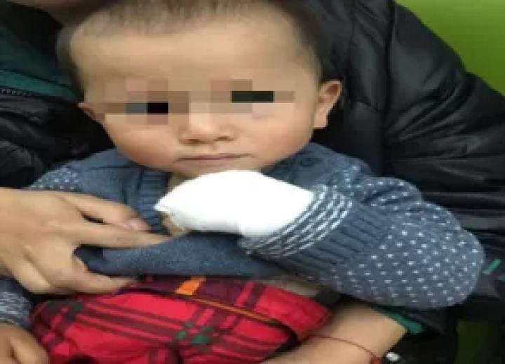 婴儿过敏全身泛红用药,8个月宝宝过敏脸上身上都红红的