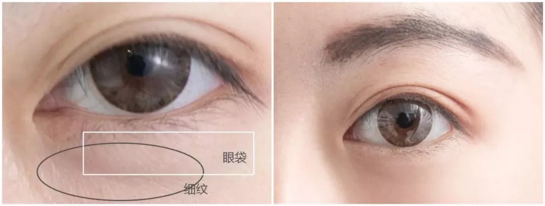 清洁毛孔黑头粉刺吸尘器,doco超微小气泡毛孔吸尘器直播