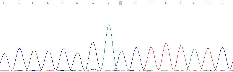 最稀缺的血型比熊猫血还稀缺,稀有的血型除了熊猫血还有什么血