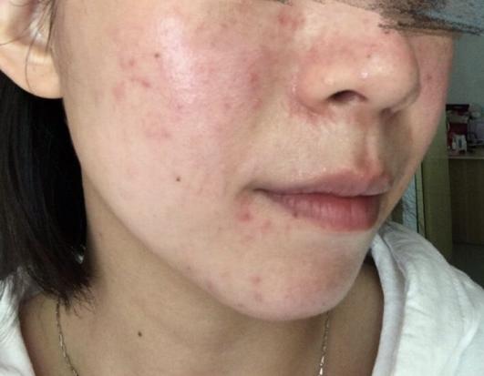 pony使用的底妆,pony化妆从洗脸开始