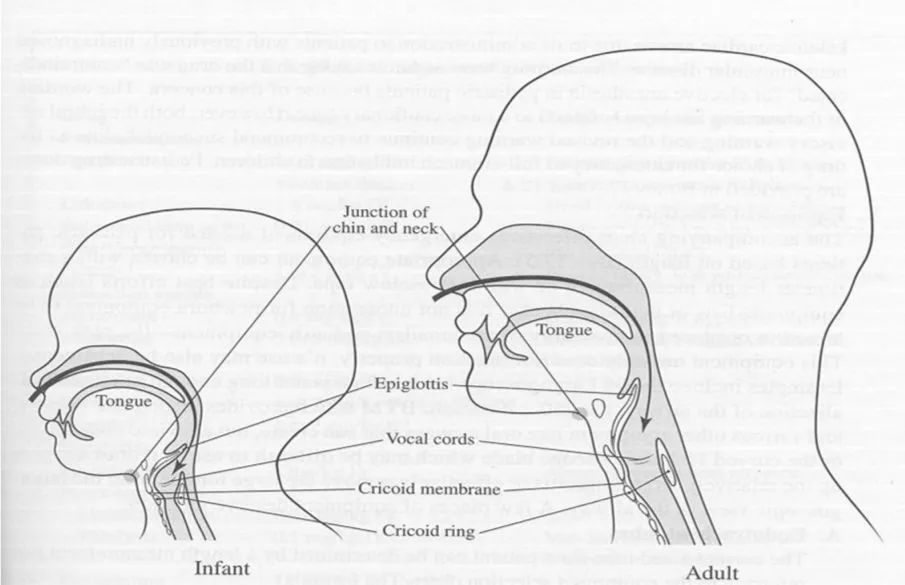 气道异物患者麻醉,小儿气道异物麻醉
