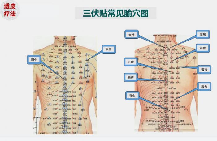 冬病夏治别错过三伏贴趁热贴起来,三伏贴入伏首日冬病夏治进行中