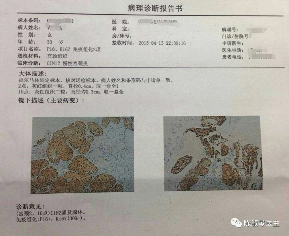 宫颈活检取纱布特别疼,宫颈活检取纱布疼吗