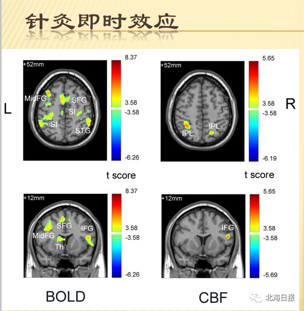 预告|博士大讲堂第十三期：工学博士张钺为你揭秘“大脑的那些事”
