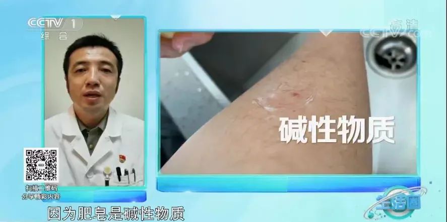 被蚊子咬了痒的不行最常用的办法,被蚊子咬了好几天了还非常痒