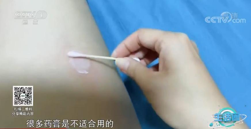 被蚊子咬了痒的不行最常用的办法,被蚊子咬了好几天了还非常痒