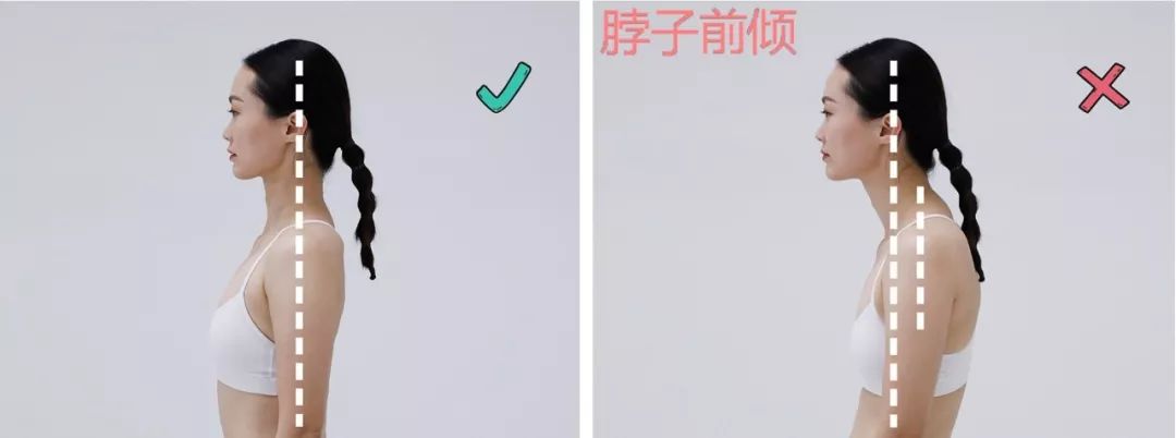 体态显老该怎样矫正图片,最难看的几种体态