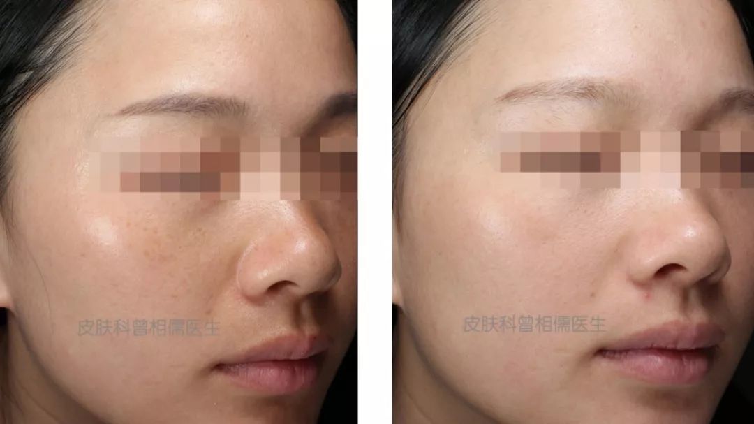 9个最简单有效的美白方法,6个最有效的美白方式你造吗