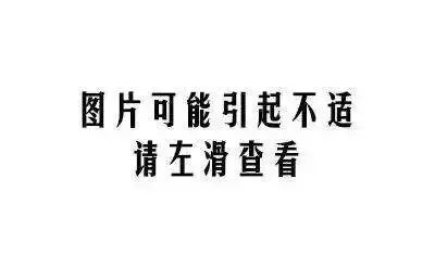 22岁女孩体内竟有上千颗肿瘤现状,女子腹中长肿瘤18cm