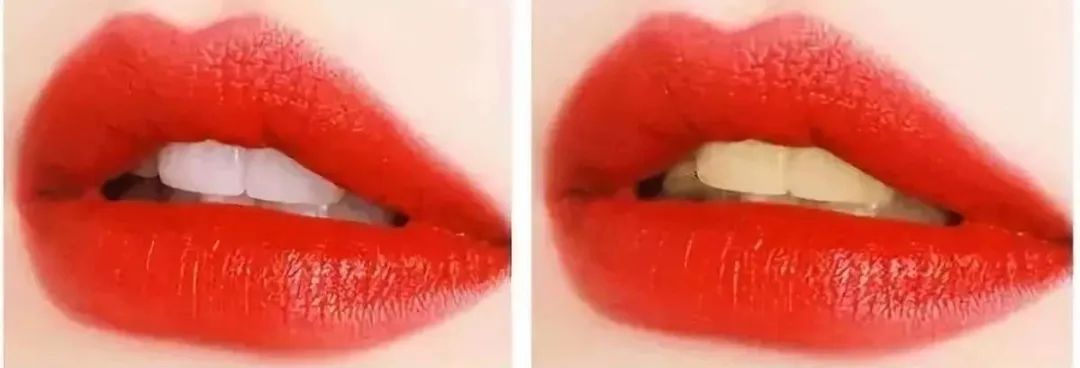 牙齿变黄你真的刷对了吗,牙齿黄了怎么办不用花钱去洗牙