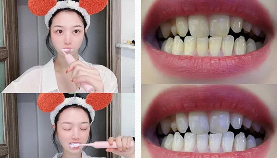 牙齿变黄你真的刷对了吗,牙齿黄了怎么办不用花钱去洗牙