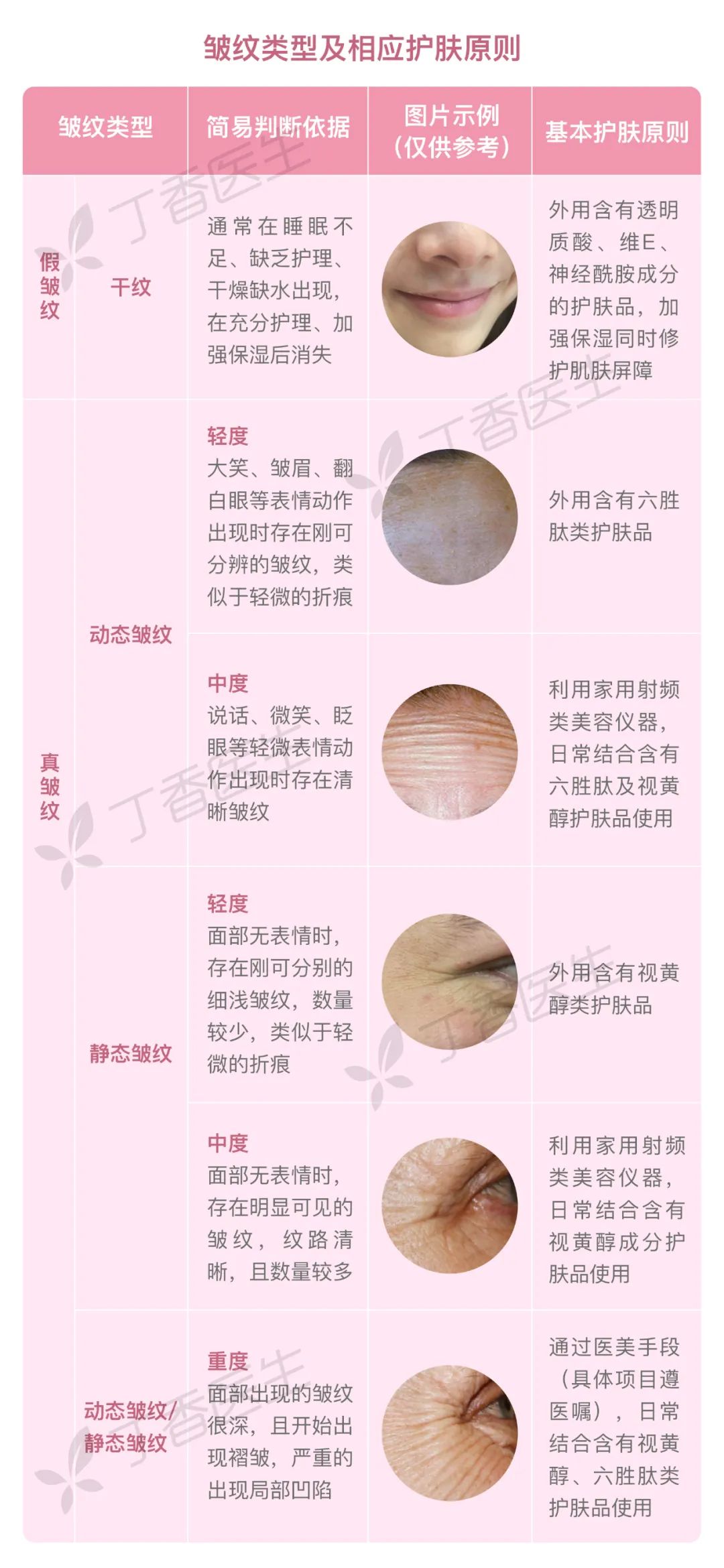 眼角长皱纹了怎么办,长皱纹了怎么办