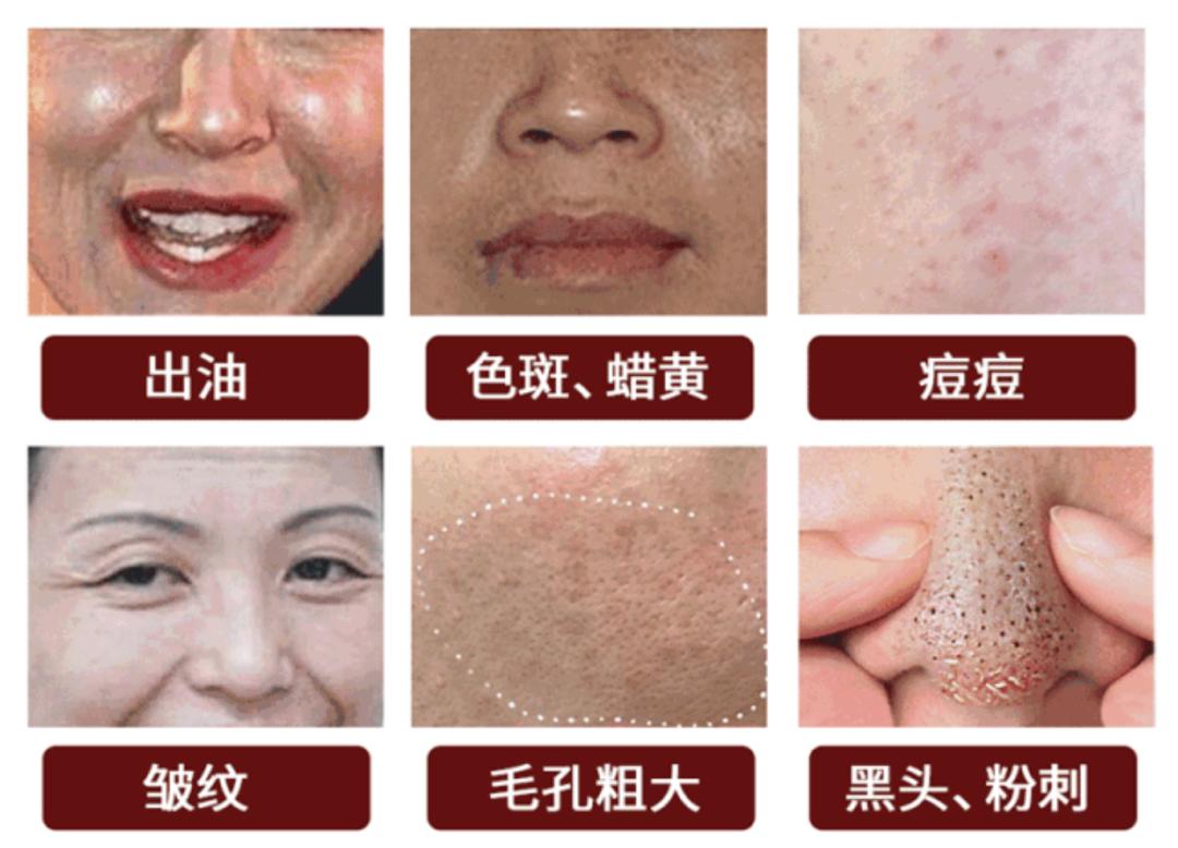 日本人用酒洗脸，60岁还没有皱纹，黑头粉刺全消失，整张脸白皙光滑，细腻弹润