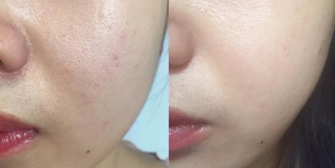 日本人用酒洗脸，60岁还没有皱纹，黑头粉刺全消失，整张脸白皙光滑，细腻弹润