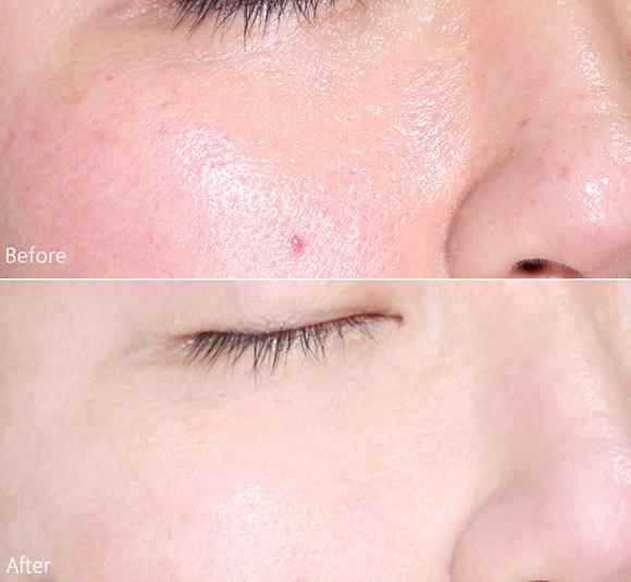 日本人用酒洗脸，60岁还没有皱纹，黑头粉刺全消失，整张脸白皙光滑，细腻弹润