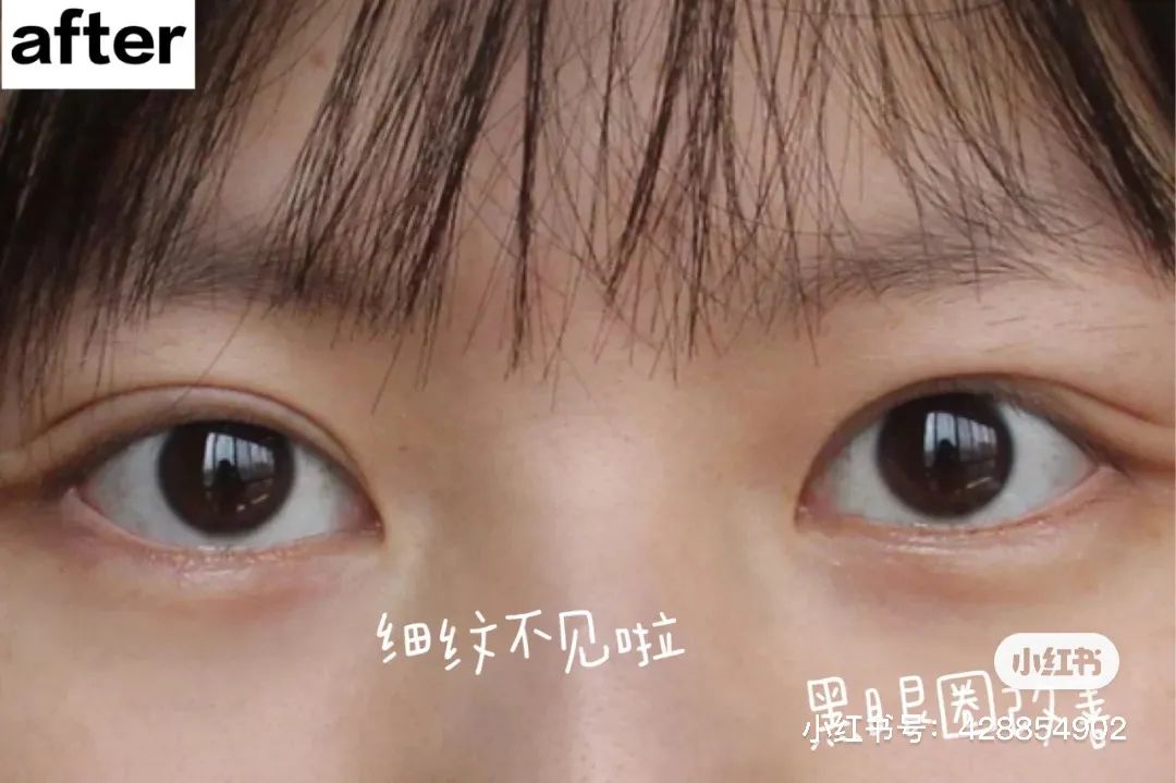 超级好用的眼膜免费送,试用装免费包邮眼膜