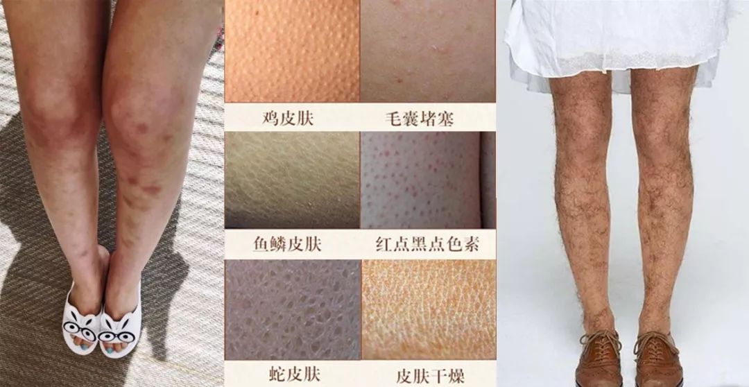 秋冬怎么穿出骨感腿,秋冬温柔甜系不露腿穿搭