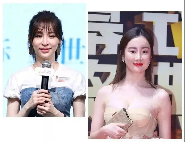 抬头纹眉间纹怎么去除,眉间纹抬头纹去除最好的方法