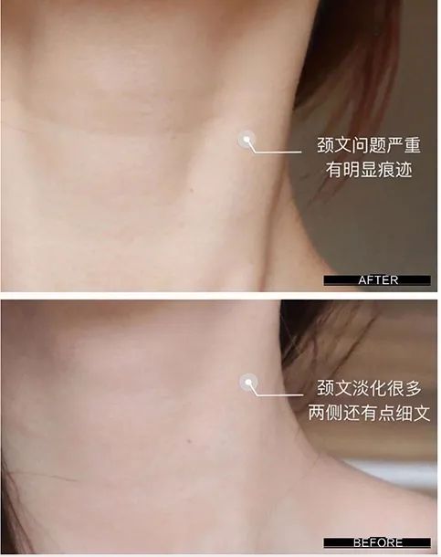 眼霜正品大品牌欧莱雅,眼霜欧莱雅紫熨斗正品