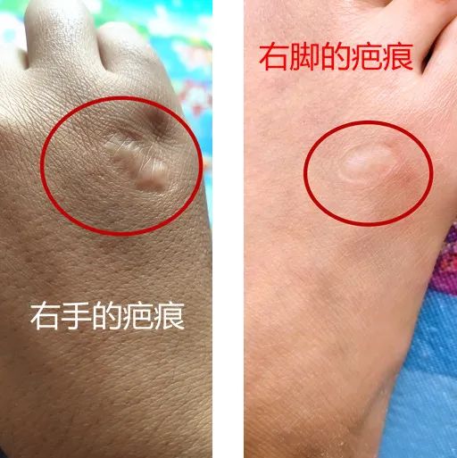 瀵讳翰鐢熺埗姣嶈儗鍚庢湁鑳庤,瀵讳翰鐢熺埗姣嶅ご椤舵湁绾㈣壊鍗拌